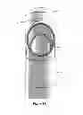 Fig. 14 - Transvaginal specimen extraction device