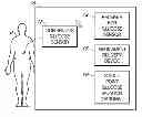 Fig. 01 - Integrated medicament delivery device for use with continuous analyte sensor