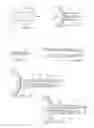 Fig. 06 - Apparatus and method to provide emergency access to bone marrow