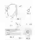 Fig. 02 - INTRAVASCULAR CATHETER