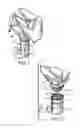 Fig. 02 - Abscess irrigation systems