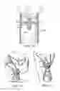 Fig. 10 - Abscess irrigation systems