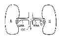 Fig. 01 - Methods for bilateral renal neuromodulation
