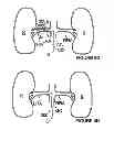 Fig. 08 - Methods for bilateral renal neuromodulation