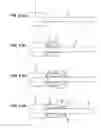 Fig. 04 - Guide wire