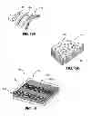 Fig. 10 - Intragastric Volume Occupying Device with Active Agents