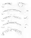 Fig. 04 - Eye surgery refraction correction