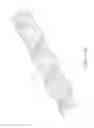 Fig. 14 - LESION TREATMENT DEVICE AND METHODS FOR TREATING LESIONS