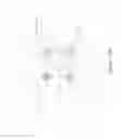 Fig. 45 - LESION TREATMENT DEVICE AND METHODS FOR TREATING LESIONS