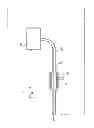 Fig. 08 - Hyperthermia treatment and probe therefore