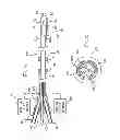 Fig. 09 - Hyperthermia treatment and probe therefore