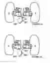 Fig. 09 - Methods for bilateral renal neuromodulation
