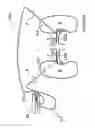 Fig. 10 - Methods for bilateral renal neuromodulation