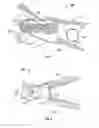Fig. 03 - Jaw closure detection system
