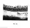 Fig. 12 - Method for selectively elevating and separating tissue layers and surgical instrument for performing the method
