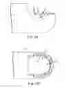 Fig. 04 - Rotary cutting tool with improved cutting and reduced clogging on soft tissue and thin bone