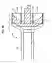 Fig. 63 - System and Method for Joint Resurface Repair
