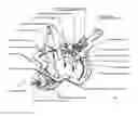 Fig. 01 - System and method for performing measurable and controled osteotomy