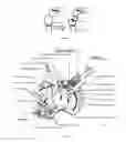 Fig. 02 - System and method for performing measurable and controled osteotomy
