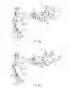 Fig. 06 - Knee arthroplasty instrument