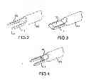 Fig. 04 - Vertebral joint implants and delivery tools