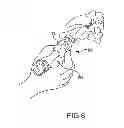 Fig. 06 - Vertebral joint implants and delivery tools