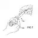 Fig. 09 - Vertebral joint implants and delivery tools