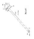 Fig. 100 - Vertebral joint implants and delivery tools