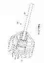 Fig. 103 - Vertebral joint implants and delivery tools