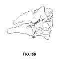 Fig. 131 - Vertebral joint implants and delivery tools