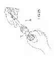 Fig. 19 - Vertebral joint implants and delivery tools