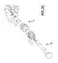 Fig. 20 - Vertebral joint implants and delivery tools