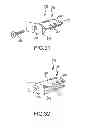 Fig. 24 - Vertebral joint implants and delivery tools