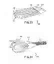 Fig. 25 - Vertebral joint implants and delivery tools