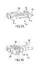 Fig. 26 - Vertebral joint implants and delivery tools