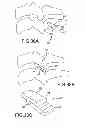 Fig. 28 - Vertebral joint implants and delivery tools