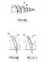 Fig. 30 - Vertebral joint implants and delivery tools