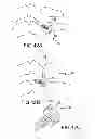 Fig. 32 - Vertebral joint implants and delivery tools