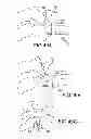 Fig. 40 - Vertebral joint implants and delivery tools