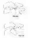 Fig. 41 - Vertebral joint implants and delivery tools