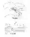 Fig. 50 - Vertebral joint implants and delivery tools