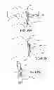 Fig. 52 - Vertebral joint implants and delivery tools