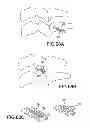 Fig. 59 - Vertebral joint implants and delivery tools