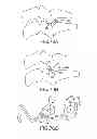 Fig. 67 - Vertebral joint implants and delivery tools