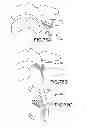 Fig. 69 - Vertebral joint implants and delivery tools