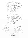 Fig. 70 - Vertebral joint implants and delivery tools