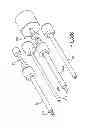 Fig. 78 - Vertebral joint implants and delivery tools