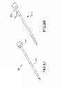 Fig. 79 - Vertebral joint implants and delivery tools