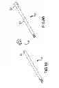 Fig. 80 - Vertebral joint implants and delivery tools