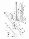 Fig. 87 - Vertebral joint implants and delivery tools